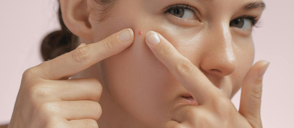 Furoncle visage : causes, symptômes, faut-il le percer ? Furoncle visage : causes, symptômes, faut-il le percer ?